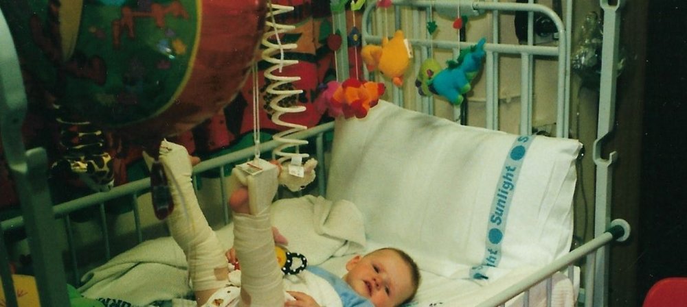 Amy lying in a bed at GOSH with her legs in traction