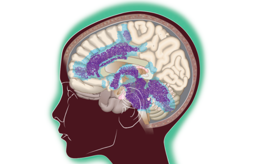 Cropped illustration showing network of highly connected brain regions involved in DMG