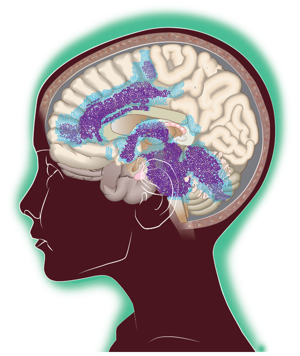 Brain illustration to show DMG network
