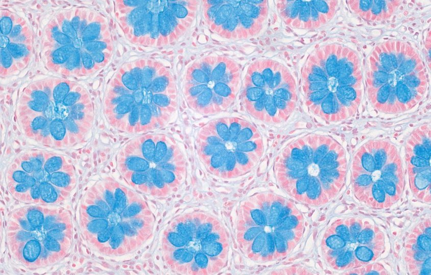 Winner of the 2025 GOSH research image competition. This floral image shows the colon of a patient with Hirschsprung disease, a rare childhood bowel disease.