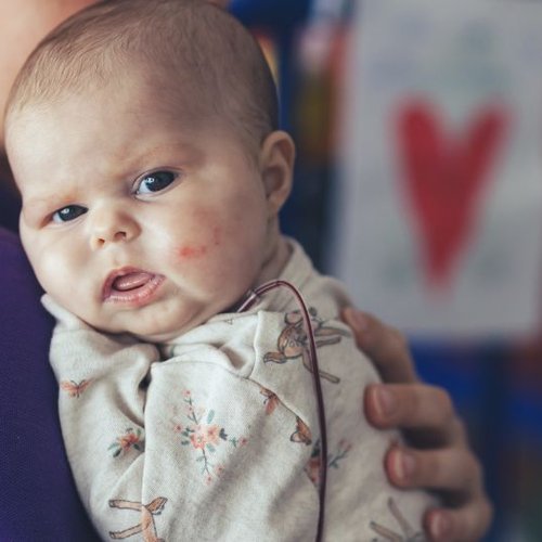 Baby in hospital room. She is looking to camera.