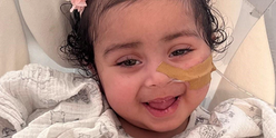 Little girl with feeding tube smiling to camera