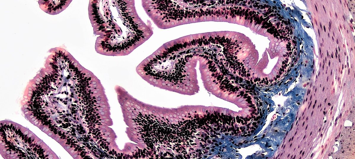 Microscope image of epithelial tissues
